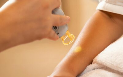 Your Complete Guide to Laser Hair Removal: What to Expect